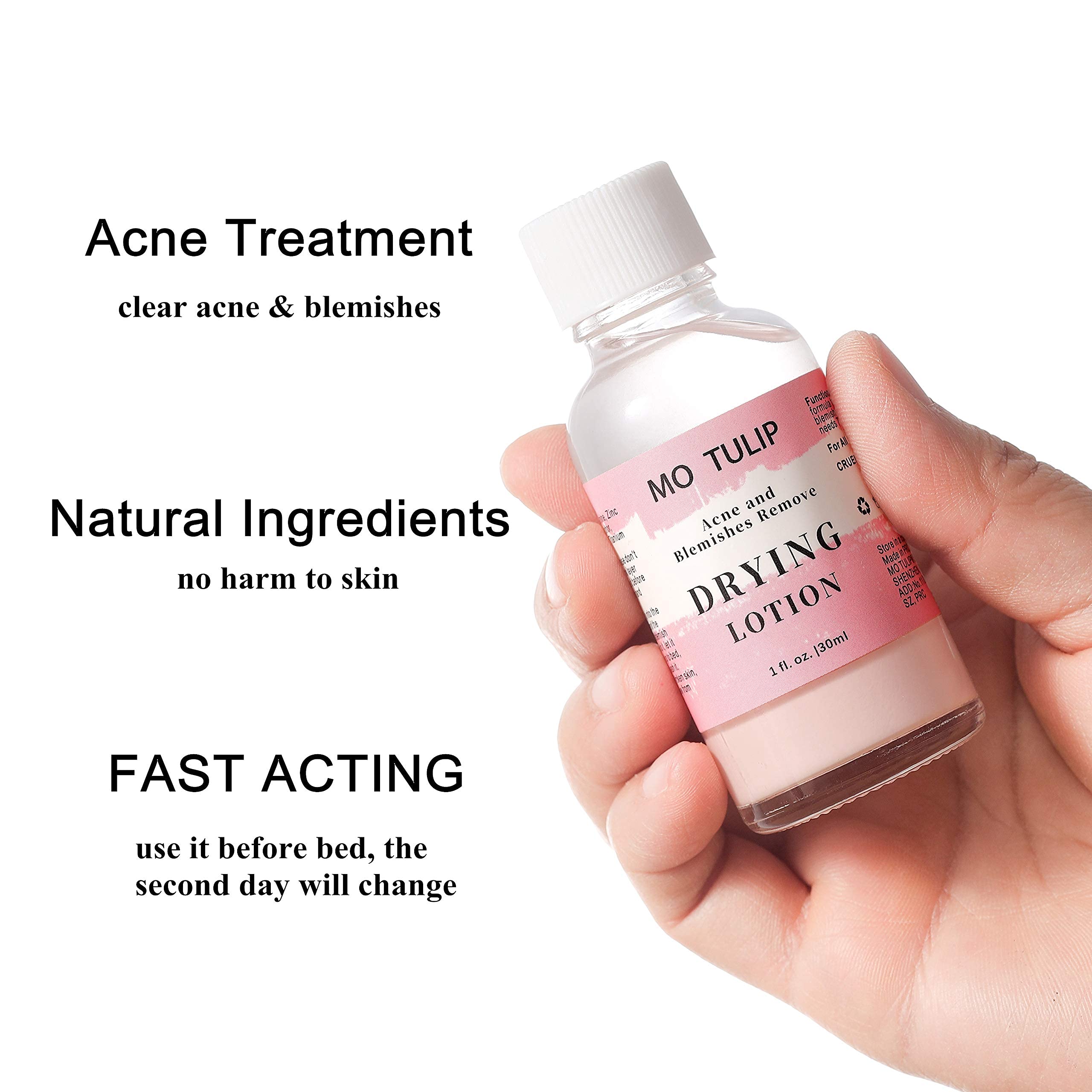 MO TULIP Acne Drying Lotion, Overnight Acne Acid and Acne Spot Treatment for Face and Body, Pimple Lotion Spot Treatment, Dry Out Pimples, Blemishes, and Clean pores (1OZ)